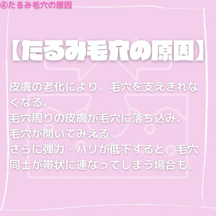 ジェムミラクル ブラックパール O2バブルマスク/the SAEM/洗い流すパック・マスクを使ったクチコミ(5枚目)