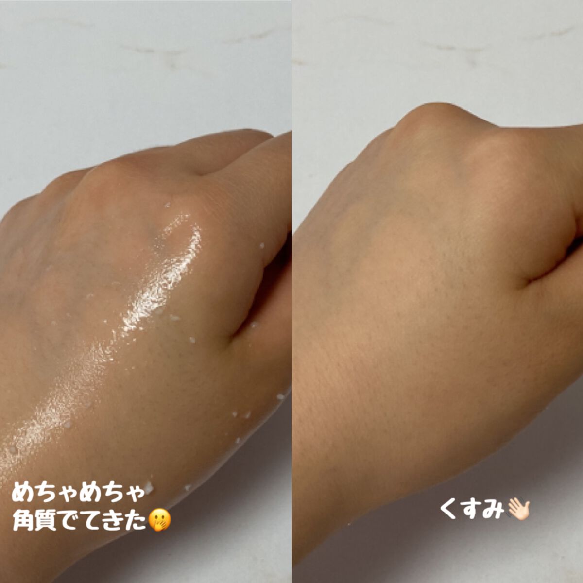 フェイシャルマイルドピーリング/primera/ピーリングを使ったクチコミ(2枚目)