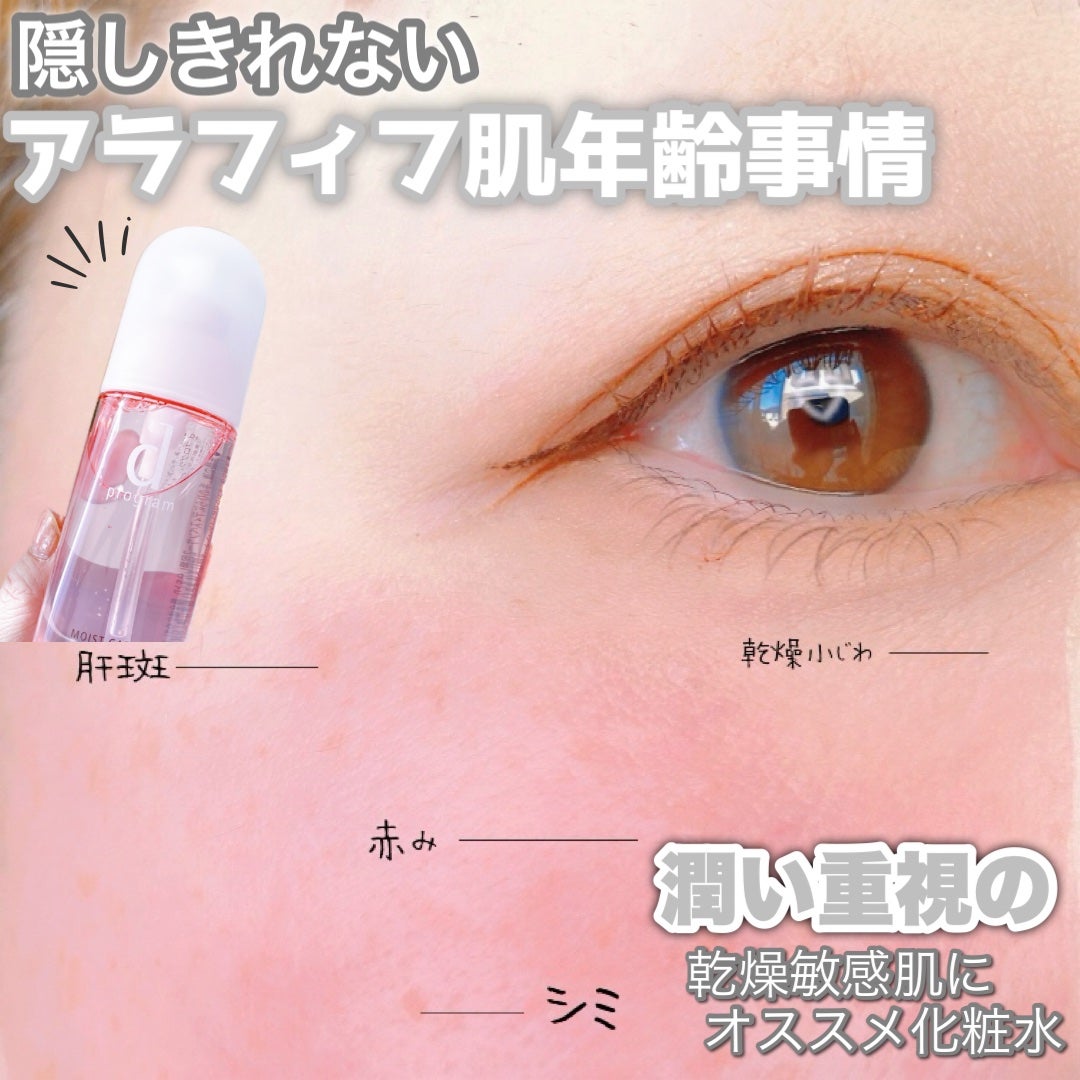 モイストケア ローション MB/d プログラム/化粧水を使ったクチコミ(1枚目)