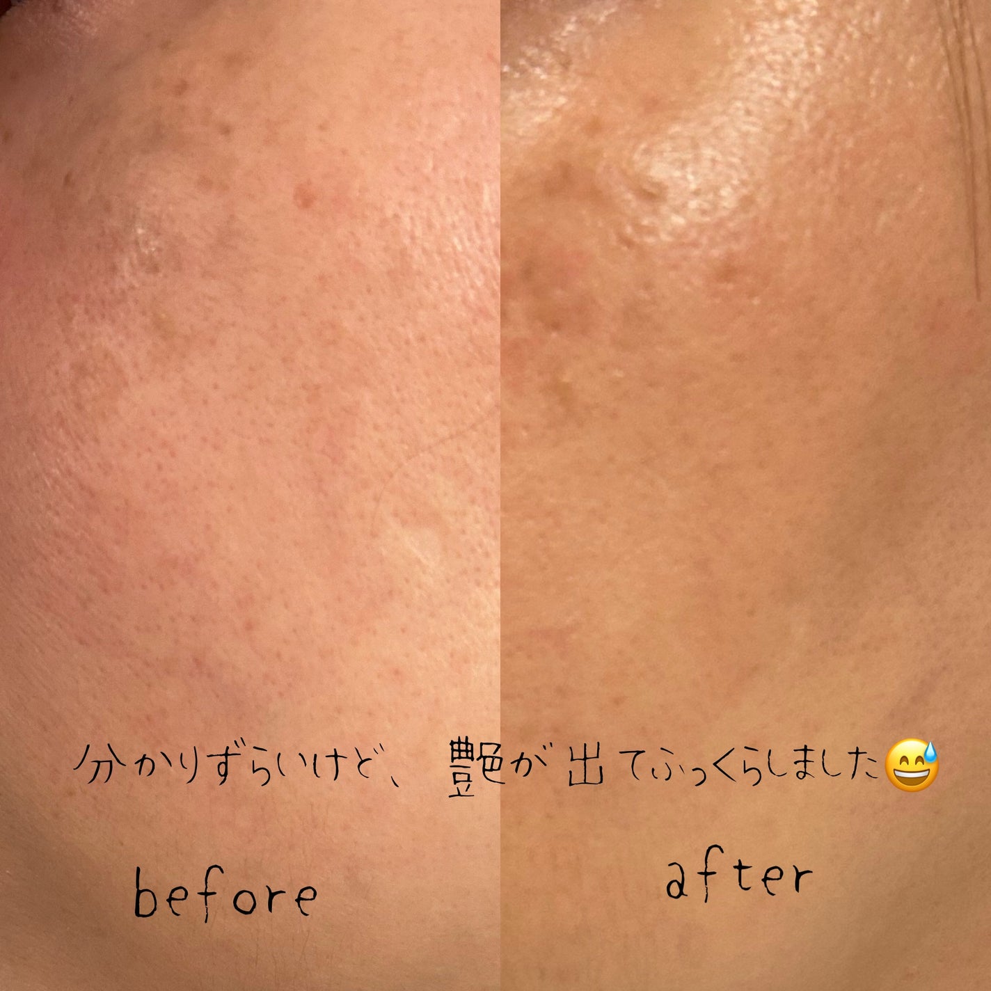 コンサントレイリュミナトゥール/クレ・ド・ポー ボーテ/スキンケアキットを使ったクチコミ(4枚目)