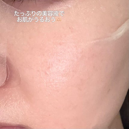 センテラ ウォーターゲルシートアンプルマスク/SKIN1004/シートマスク・パックを使ったクチコミ(5枚目)