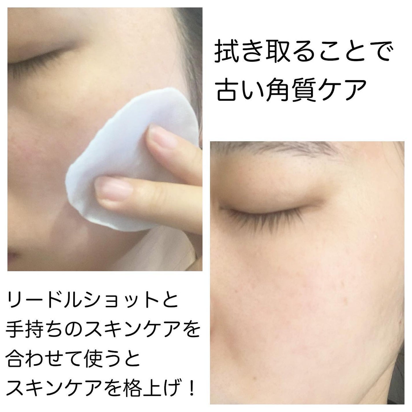 リードルショット100/VT/美容液を使ったクチコミ(5枚目)