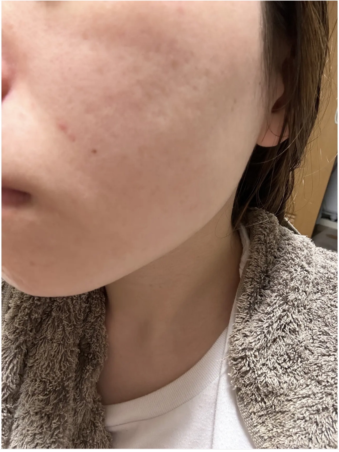 ディープビタCパッド/MEDICUBE/トナーパッドを使ったクチコミ（3枚目）