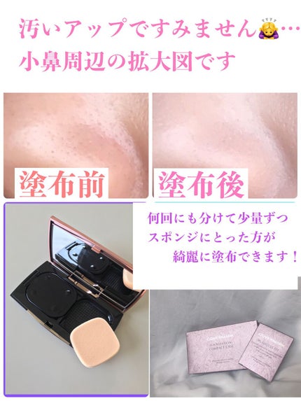 フローレス フィット/COVERMARK/クリーム・エマルジョンファンデーションを使ったクチコミ(5枚目)