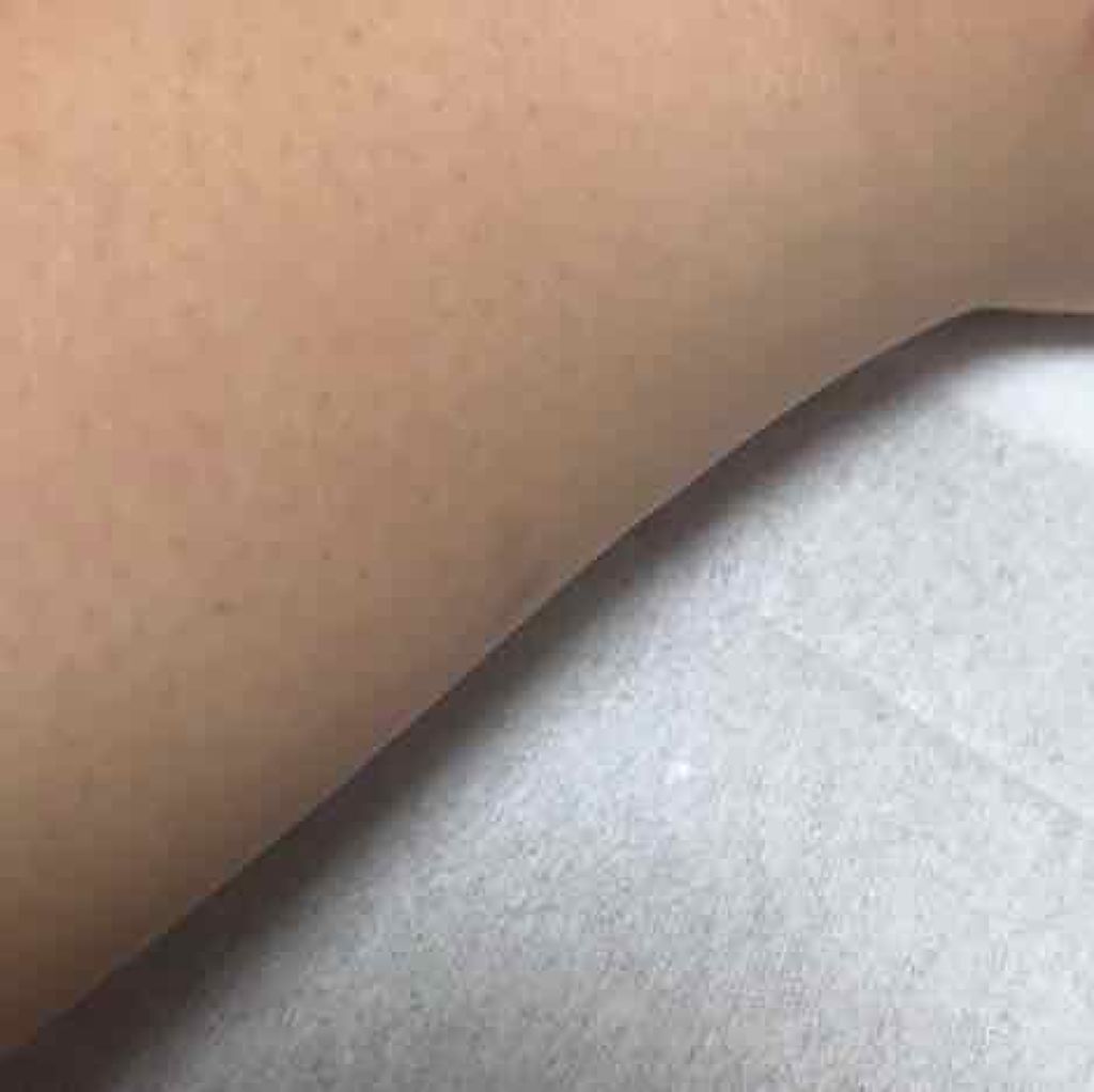 DHC はとむぎエキス/DHC/健康サプリメントを使ったクチコミ(3枚目)