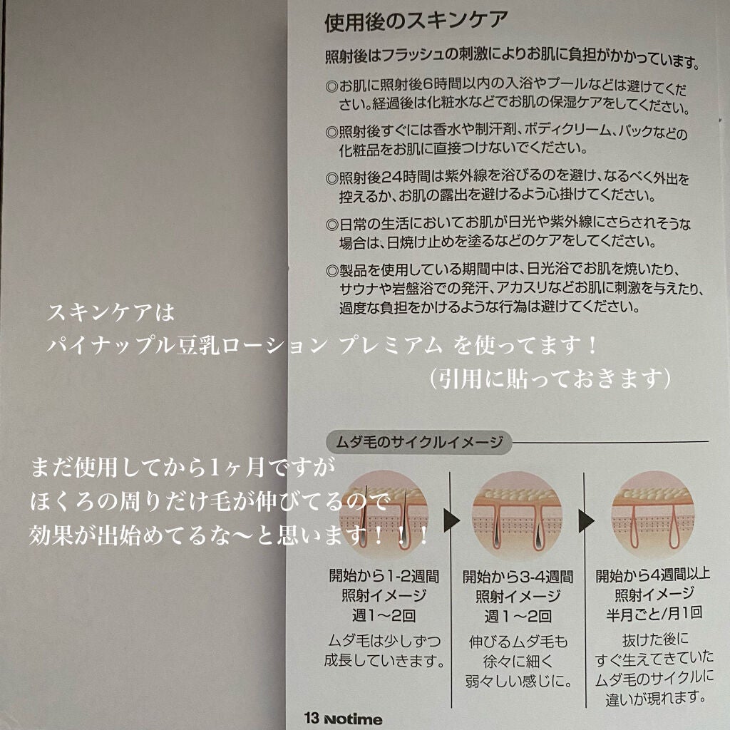 アイスレディ/icelady/家庭用脱毛器を使ったクチコミ(3枚目)