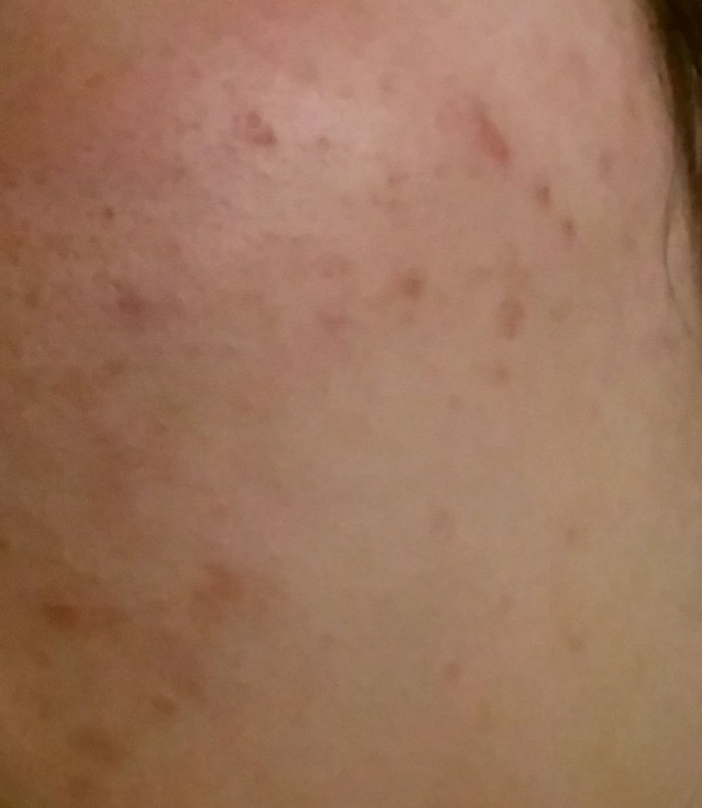 薬用クリーム洗顔/メンソレータム アクネス/洗顔フォームを使ったクチコミ(2枚目)