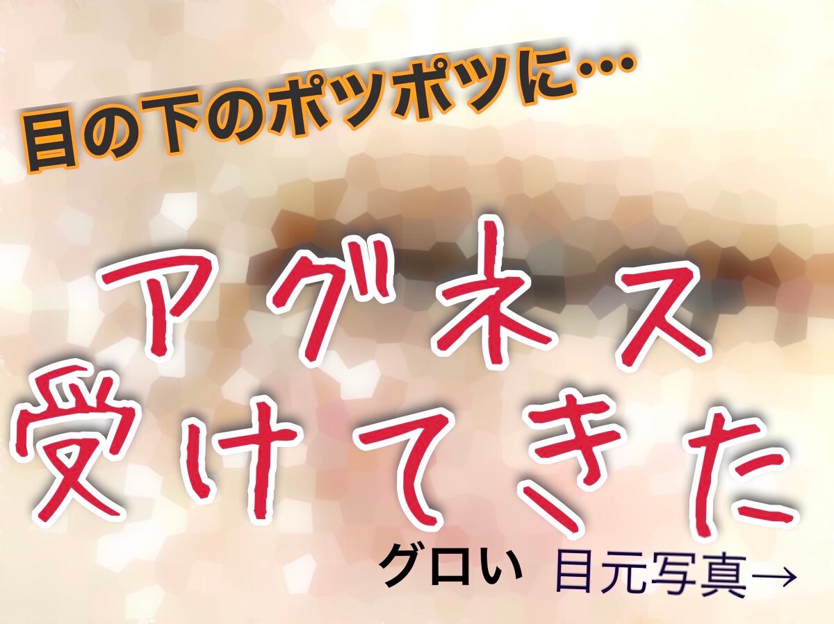 みっすん on LIPS 「目の下のポツポツをアグネスで治療してみた───────────..」(1枚目)