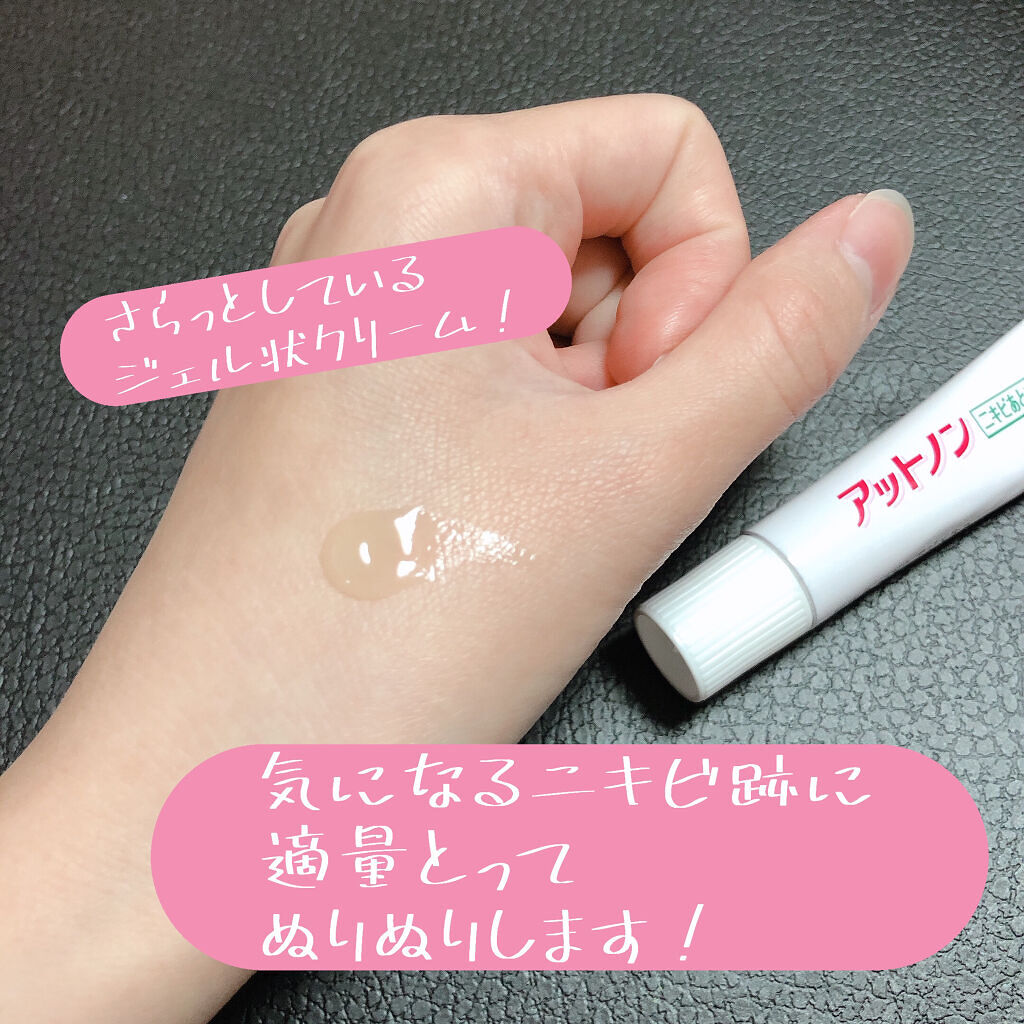 ニキビあとケアジェル/アットノン/その他スキンケアを使ったクチコミ（2枚目）