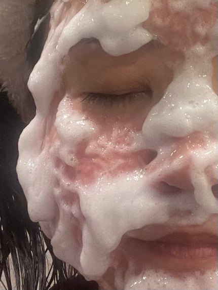 スパークリングパック/Urar /シートマスク・パックを使ったクチコミ(3枚目)