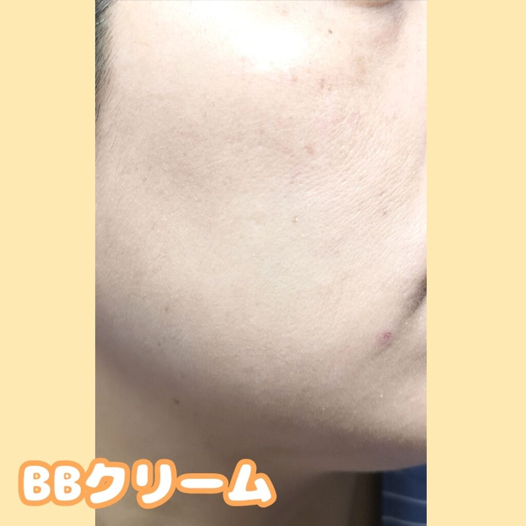 ホワイトニングクリアエマルジョン/d プログラム/乳液を使ったクチコミ（3枚目）