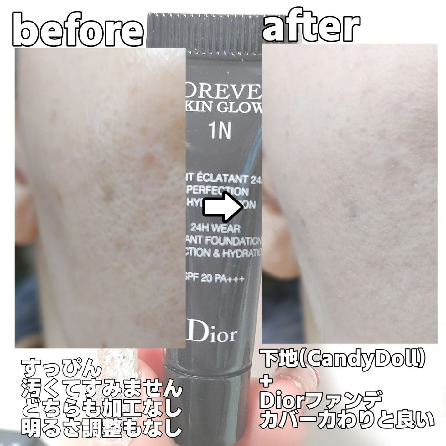 ディオールスキン フォーエヴァー フルイド グロウ/Dior/リキッドファンデーションを使ったクチコミ(5枚目)