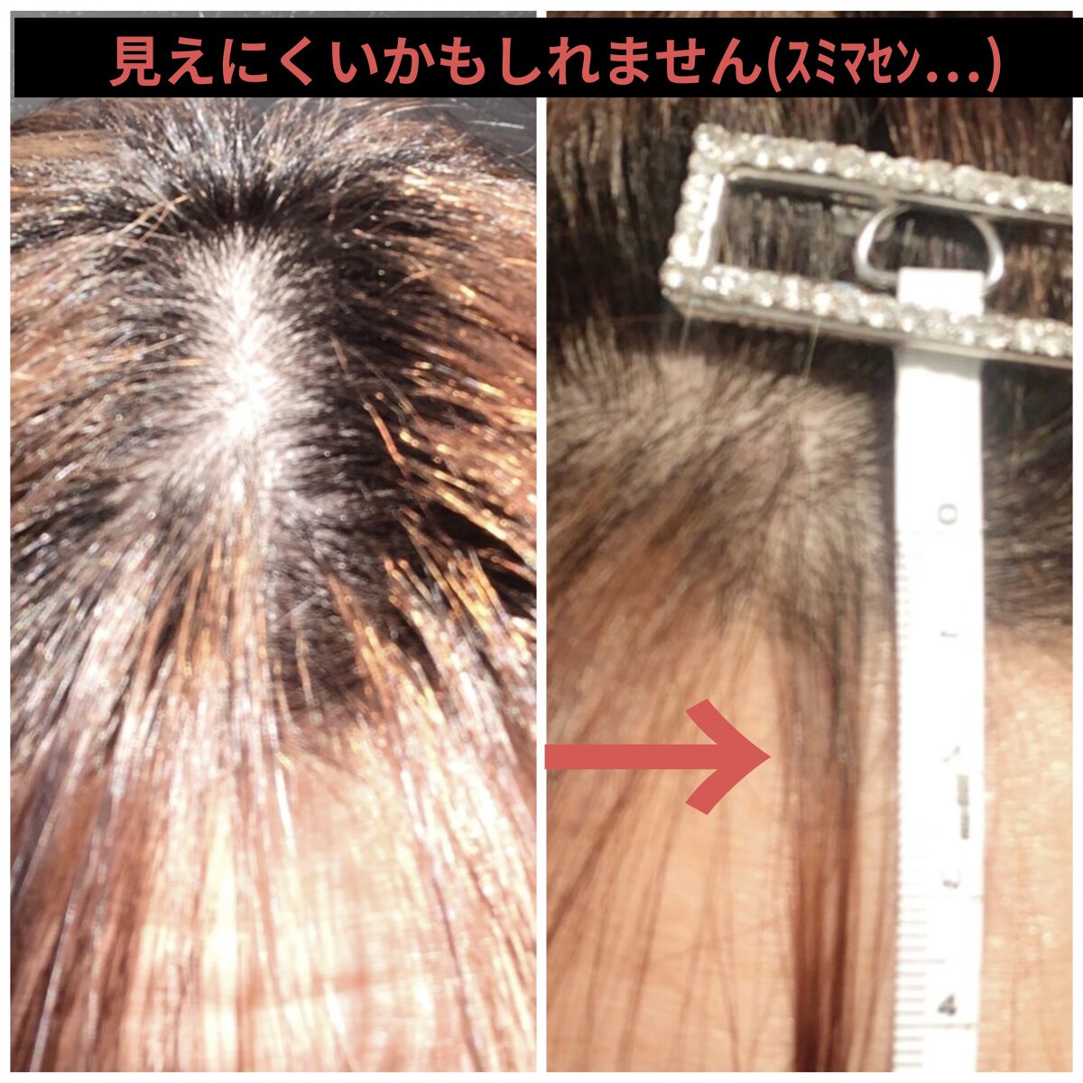 DHC 亜鉛/DHC/健康サプリメントを使ったクチコミ（2枚目）