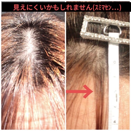 DHC 亜鉛/DHC/健康サプリメントを使ったクチコミ(2枚目)