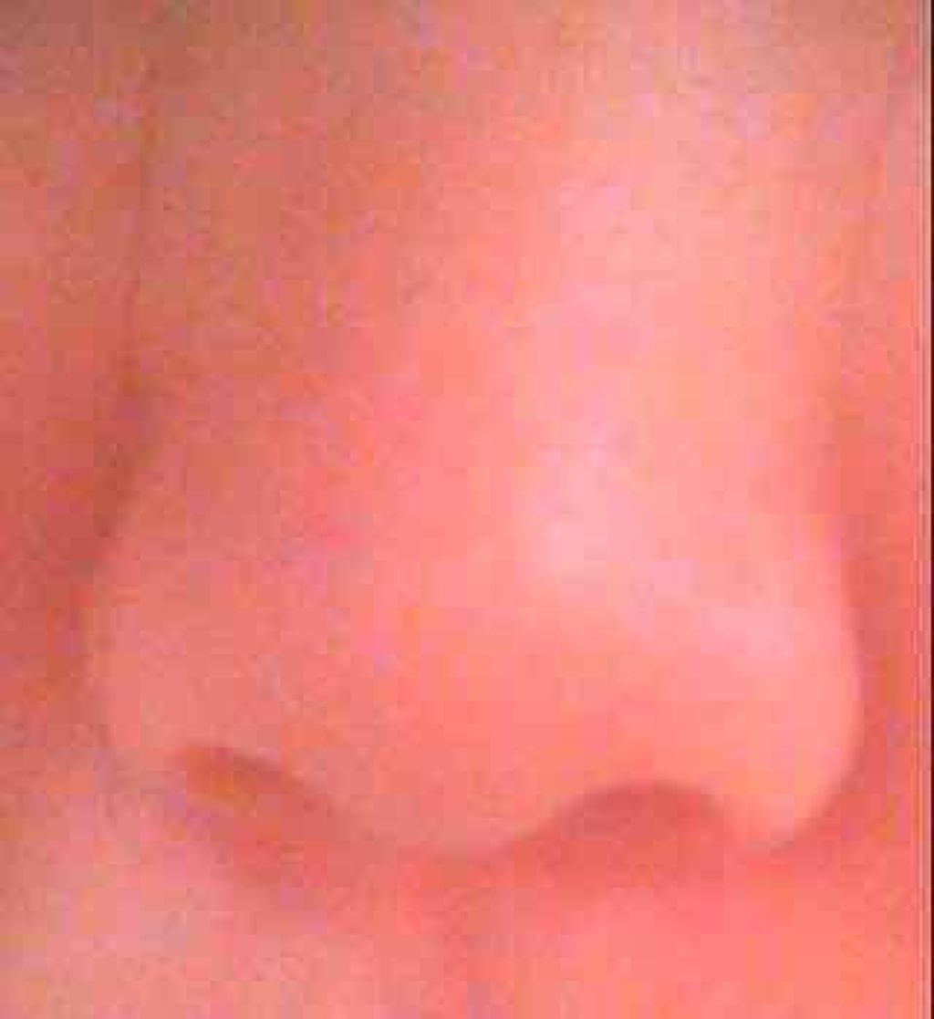 重曹スクラブ洗顔/毛穴撫子/スクラブ・ゴマージュを使ったクチコミ(3枚目)