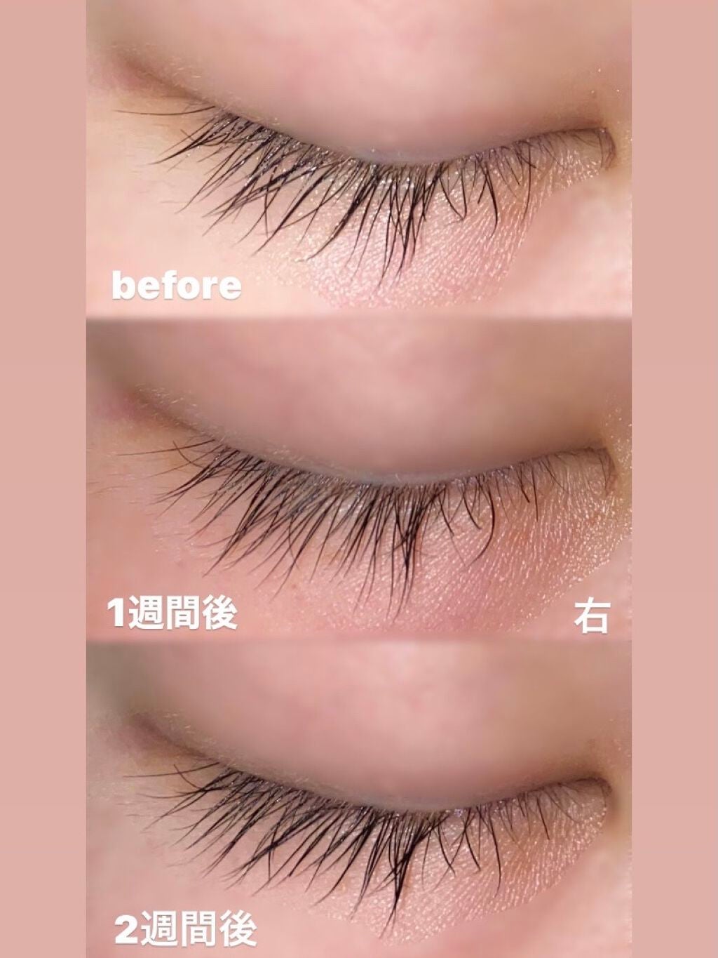アイラッシュセラム/THE STEM CELL/まつげ美容液を使ったクチコミ(3枚目)