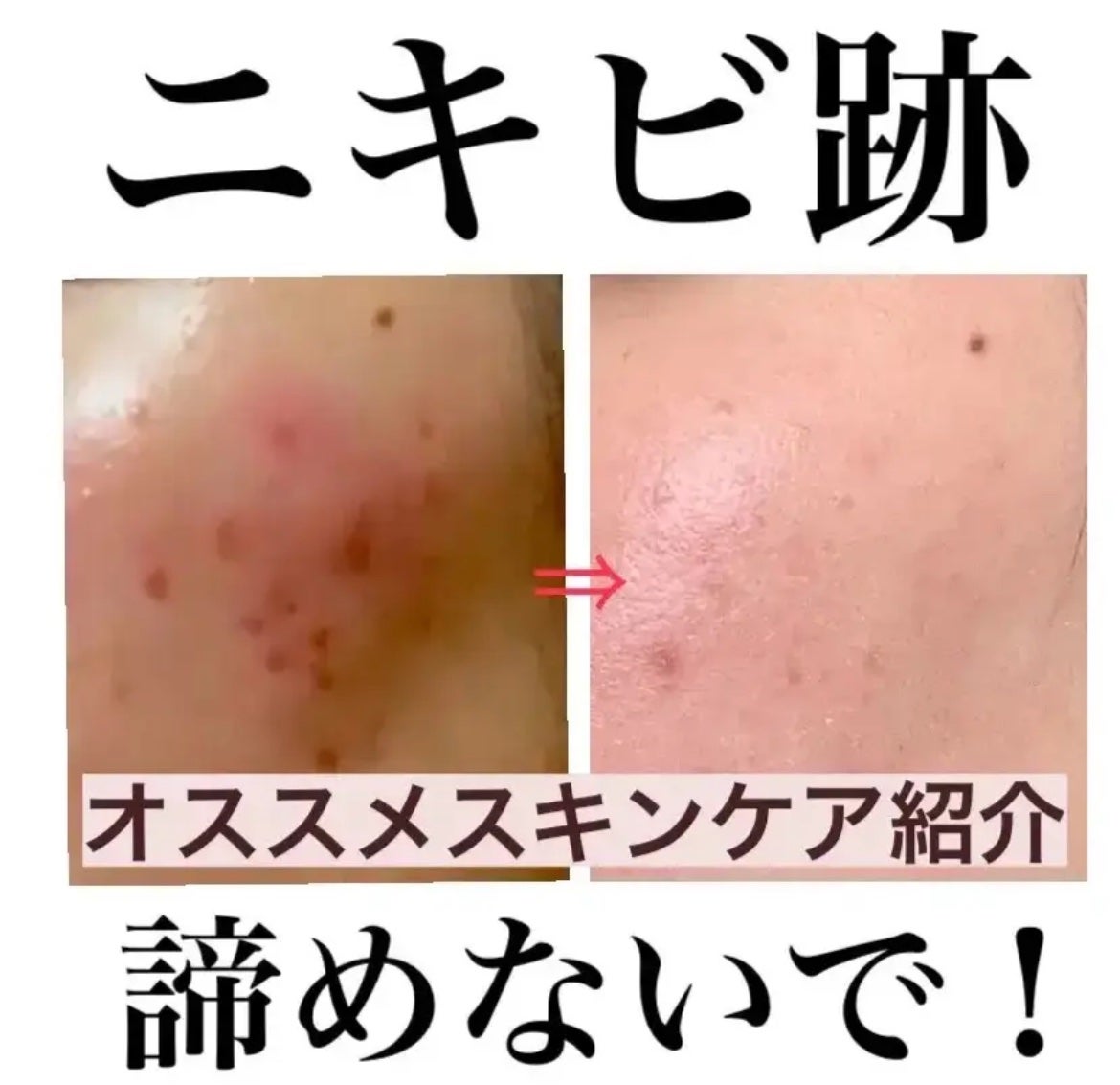 ホワイトニングクリアセラム/エトヴォス/美容液を使ったクチコミ(1枚目)