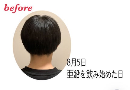 DHC 亜鉛/DHC/健康サプリメントを使ったクチコミ(2枚目)