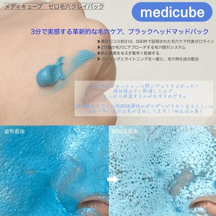 ゼロ毛穴クレイパック/MEDICUBE/洗い流すパック・マスクを使ったクチコミ(2枚目)
