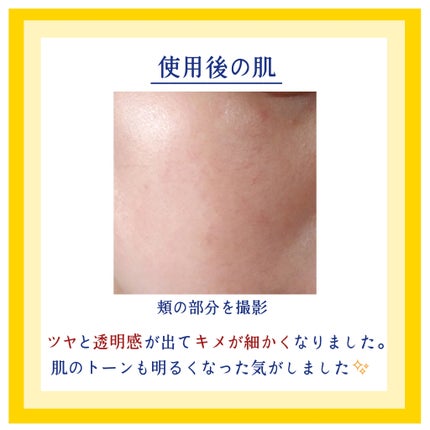 ルルルン ハイドラ V マスク/ルルルン/シートマスク・パックを使ったクチコミ(5枚目)