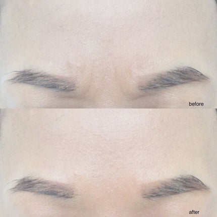 ミケンディープパッチ/北の快適工房/シートマスク・パックを使ったクチコミ(3枚目)