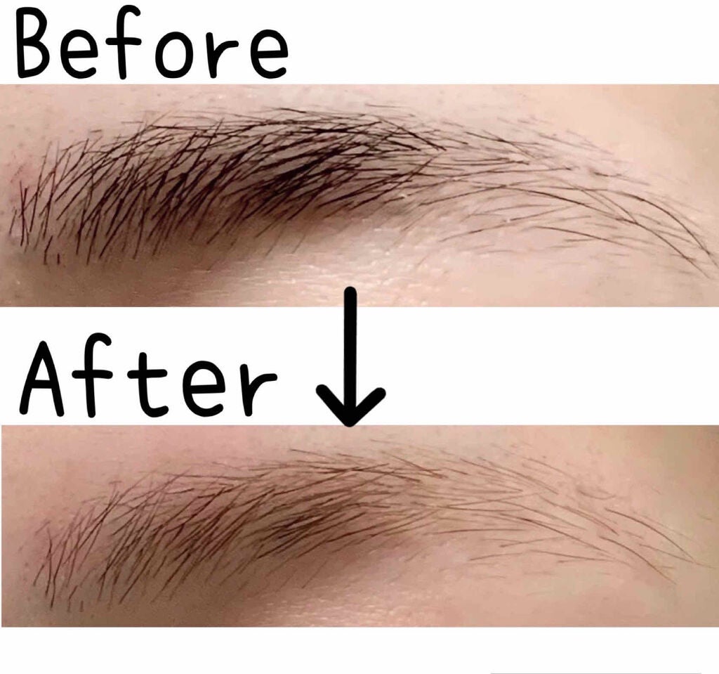 ジョレン クリーム ブリーチ/ジョレンジャパン/ムダ毛ケアを使ったクチコミ(2枚目)