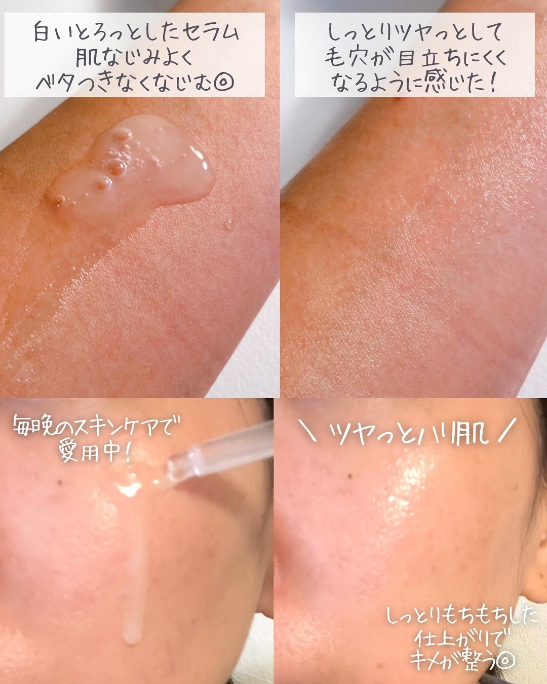 ダーマアンサー PDRN アクティブブースト1:1アンプル/CNP Laboratory/美容液を使ったクチコミ(4枚目)