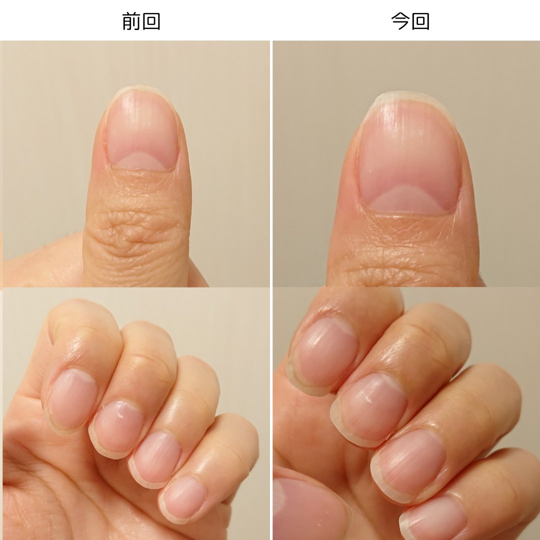 ネイルベッドオイル/アンドネイル/ネイルオイル・トリートメントを使ったクチコミ（3枚目）