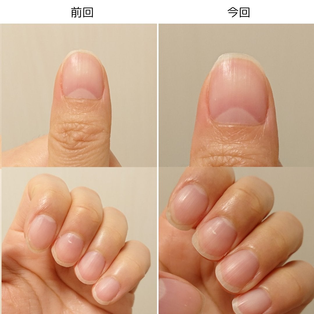 ネイルベッドオイル/アンドネイル/ネイルオイル・トリートメントを使ったクチコミ(3枚目)