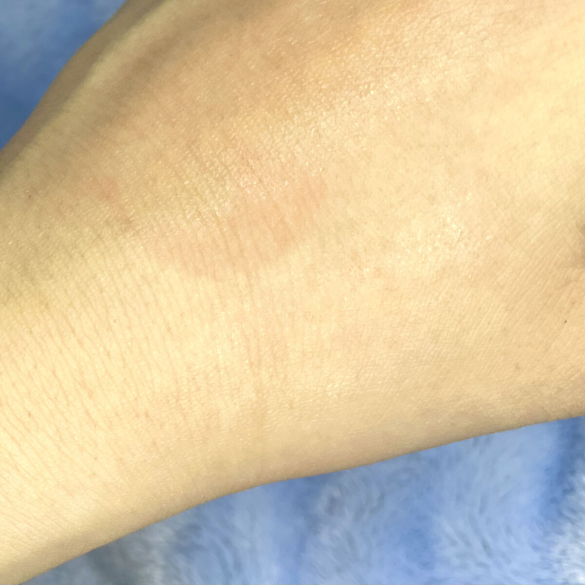 薬用ファーストエッセンス/ALBLANC/ブースター・導入液を使ったクチコミ（3枚目）