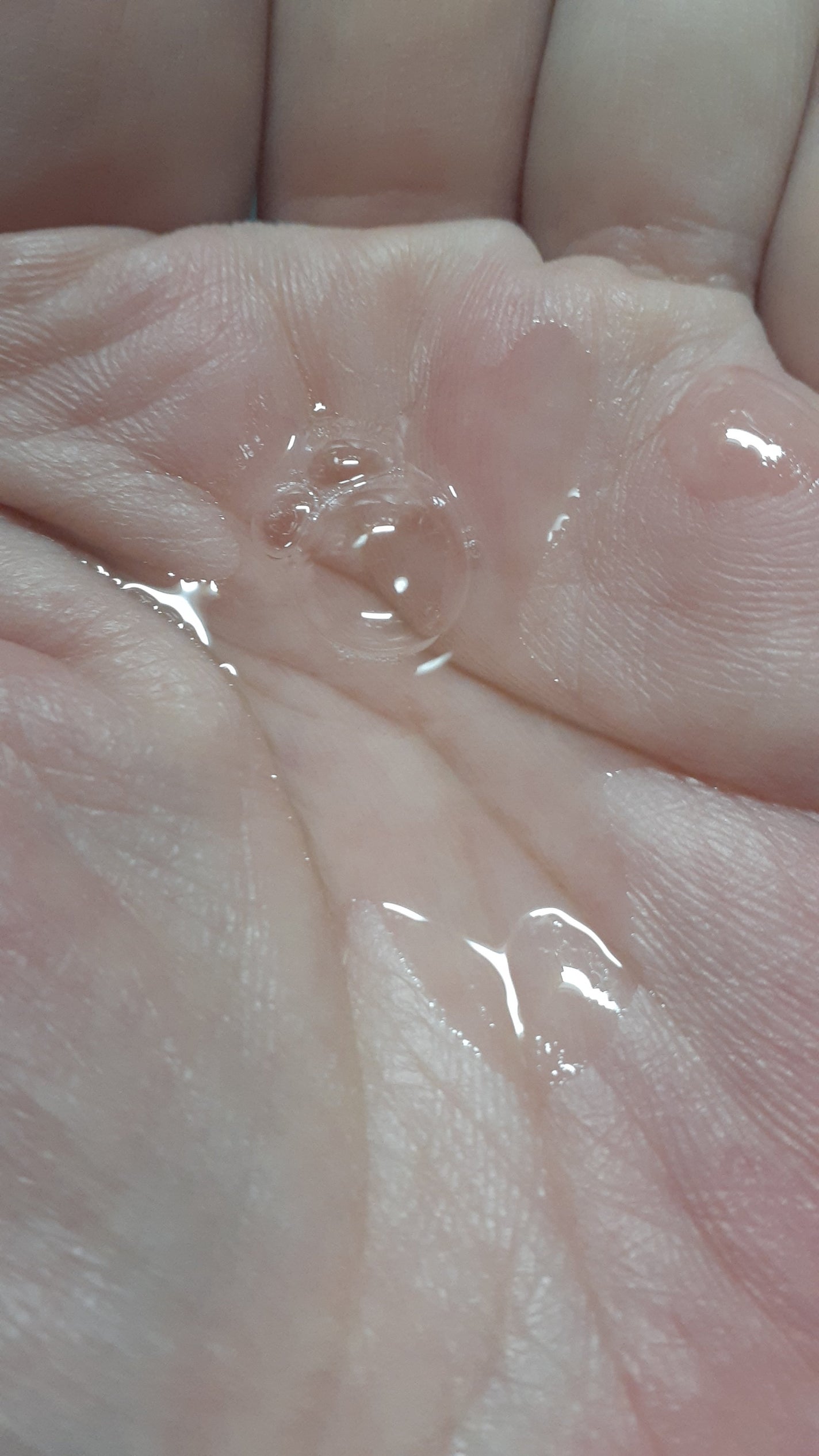 ダーマレーザースペクター ウルセラCMAX/クオリティファースト/美容液を使ったクチコミ(2枚目)