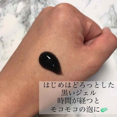 ひまちゃん /垢抜けの参考書 on LIPS 「【炭酸泡の力で毛穴を洗浄！🧼ツルツルお肌になる？！】｡.｡:+..」（2枚目）