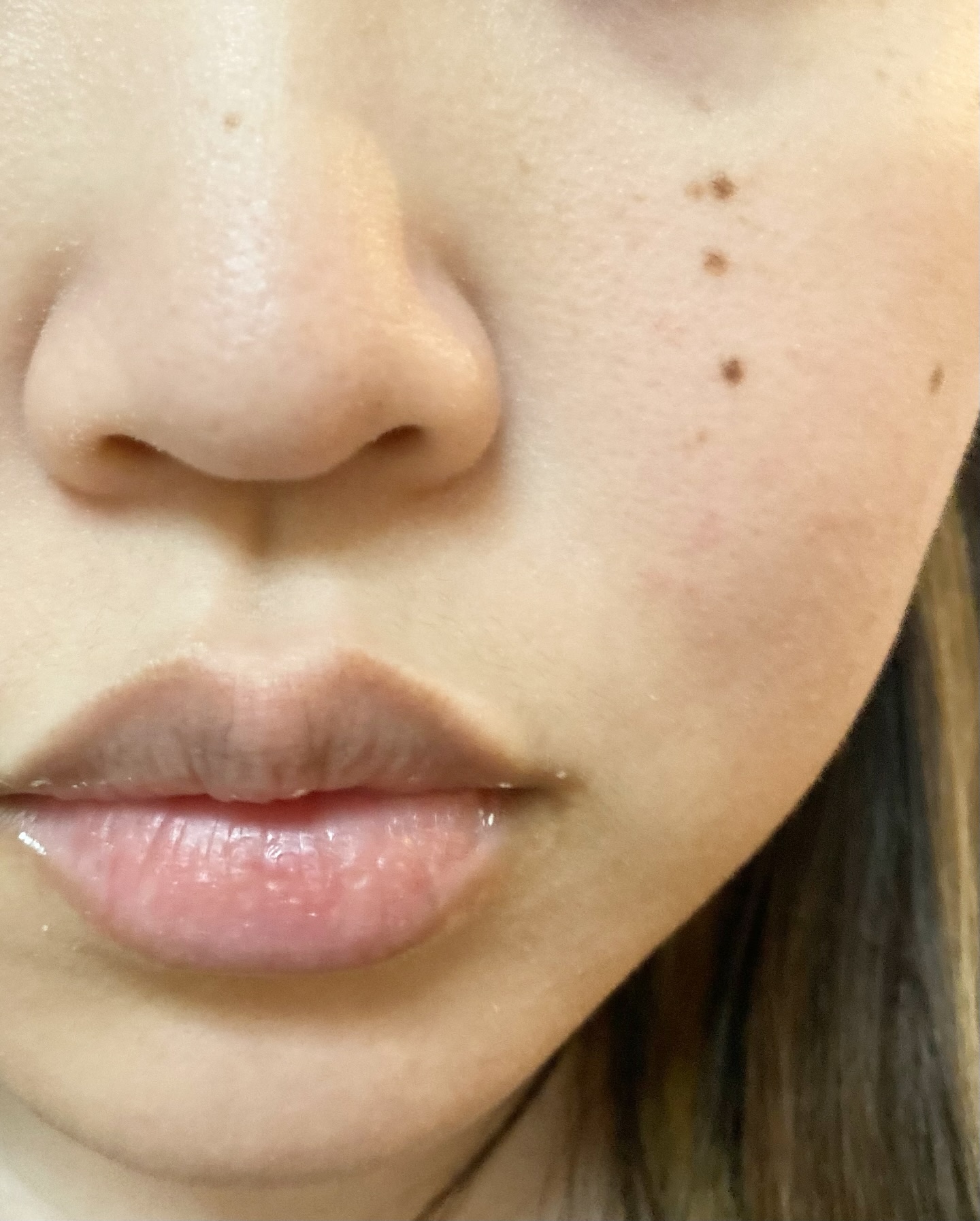 ティーツリー エッセンシャルマスクカーミングモイスチャー/MEDIHEAL/シートマスク・パックを使ったクチコミ（2枚目）