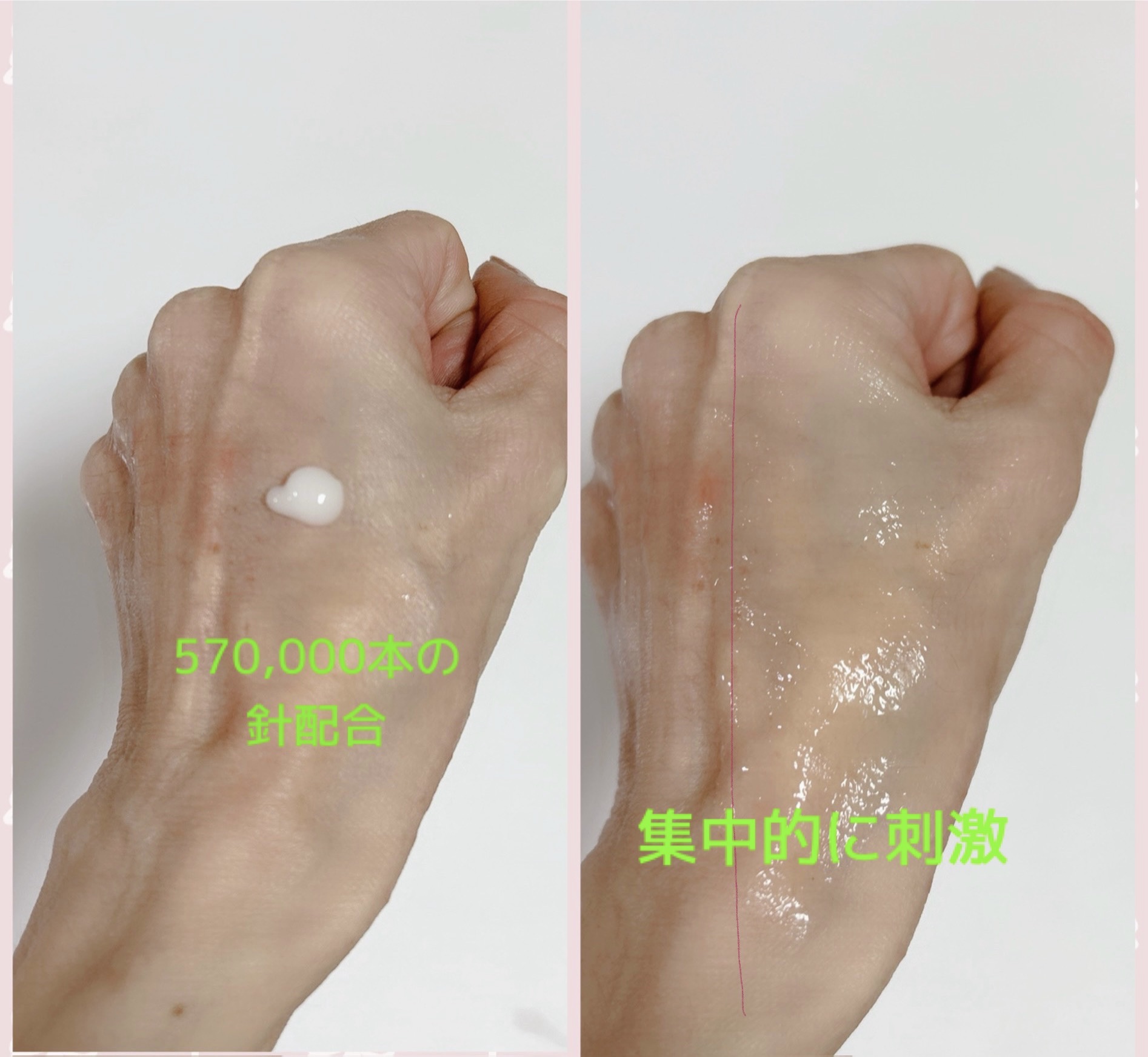 リードルショット700/VT/美容液を使ったクチコミ（3枚目）