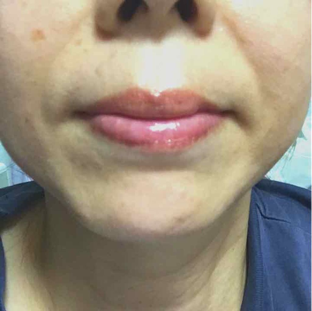 レジェンドエイジ リップ/LEGEND AGE/リップクリームを使ったクチコミ（1枚目）