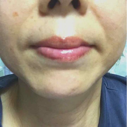 レジェンドエイジ リップ/LEGEND AGE/リップクリームを使ったクチコミ(1枚目)