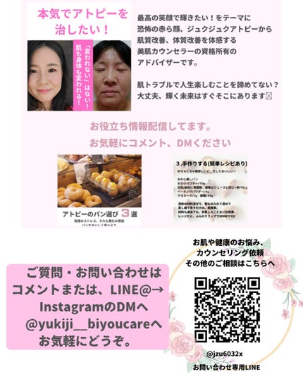 美肌カウンセラー💆肌悩みを解決し見る世界を変える on LIPS 「頭がかゆい!もうこのストレスから解放✋頭皮の悩みは深刻かゆみ、..」(10枚目)