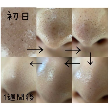 小鼻専用 洗顔ブラシ/DAISO/その他スキンケアグッズを使ったクチコミ（2枚目）
