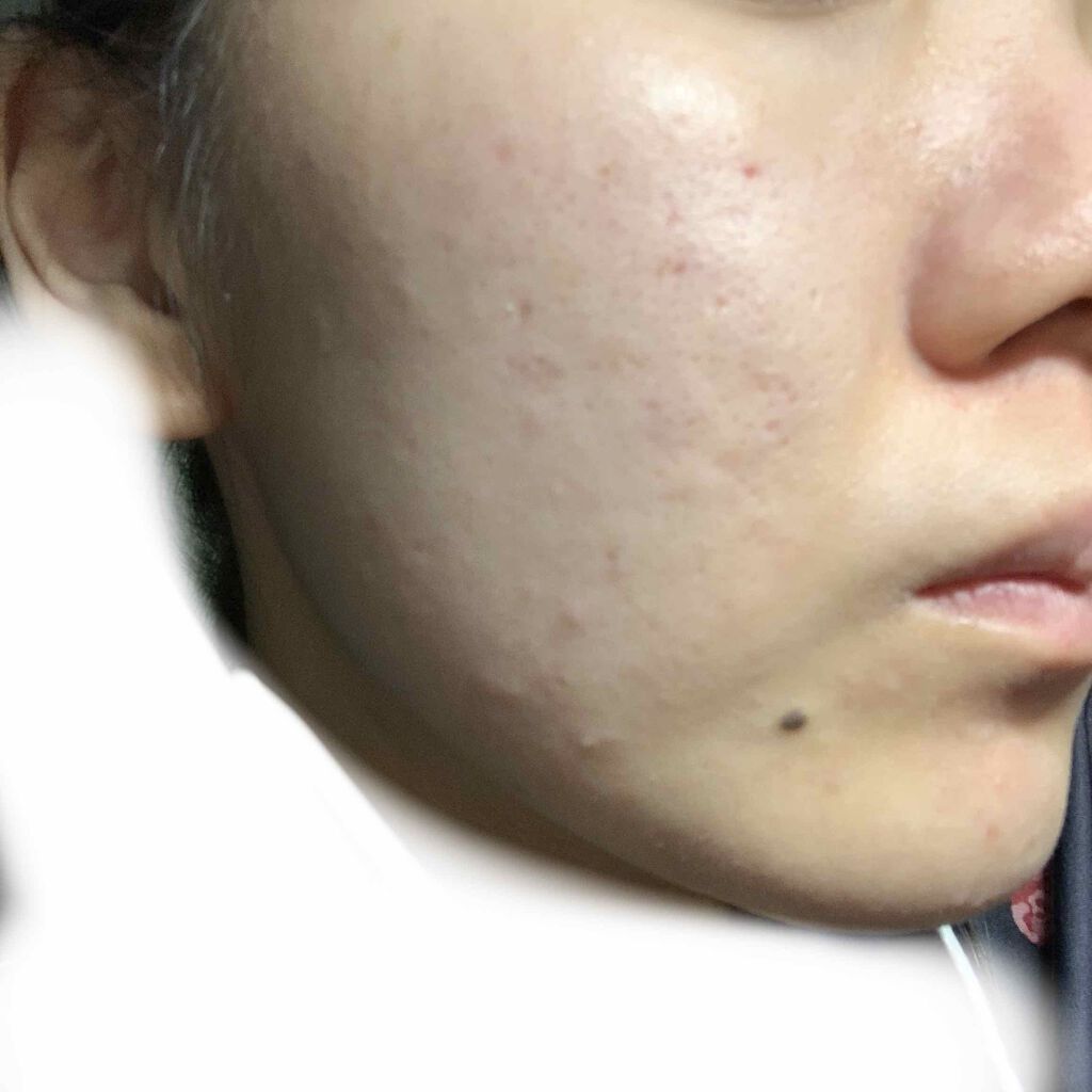 ã on LIPS ãðšå©ããŠãã ããðšèãæ±ããŠæ©ãã§ãã18æ³ã§ãå°ããé ããã¢..ãïŒ2æç®ïŒ