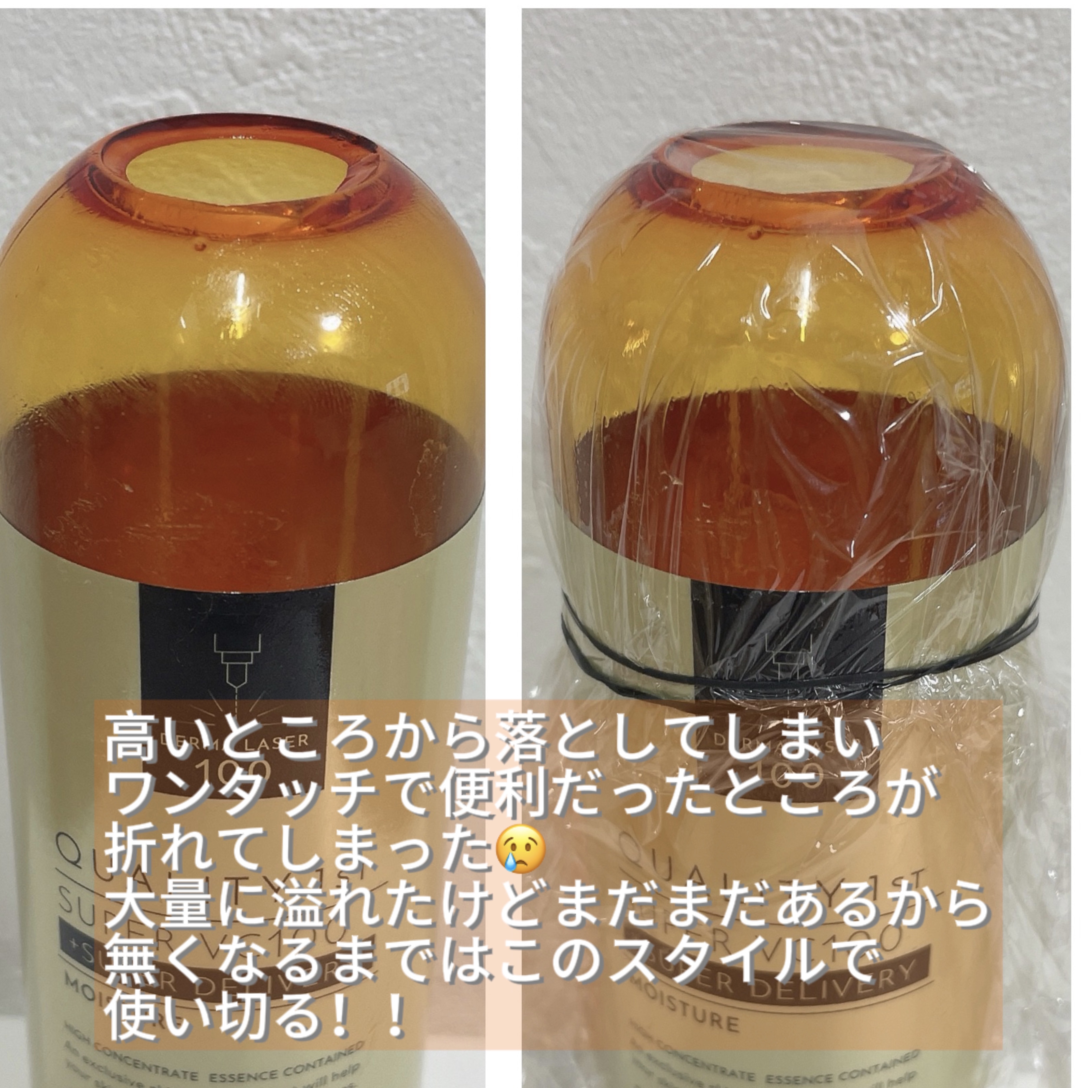 アットノンEX クリーム(医薬品)/アットノン/その他を使ったクチコミ（2枚目）