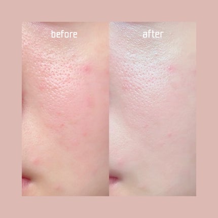 SIGNATURE ESSENCE COVER PACT /AGE20’s/クリーム・エマルジョンファンデーションを使ったクチコミ(5枚目)