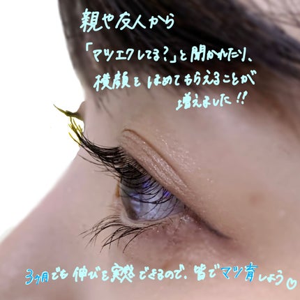 ラッシュケアエッセンス/キャンメイク/まつげ美容液を使ったクチコミ(5枚目)