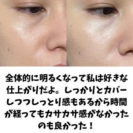 ディオールスキン フォーエヴァー スキン コレクト コンシーラー/Dior/リキッドコンシーラーを使ったクチコミ(7枚目)