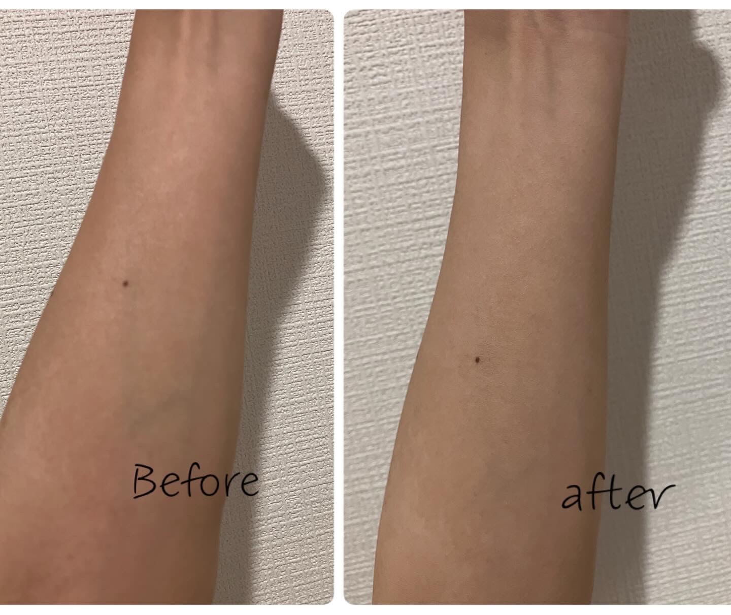 薬用ホワイトパックN/透明白肌/洗い流すパック・マスクを使ったクチコミ（2枚目）