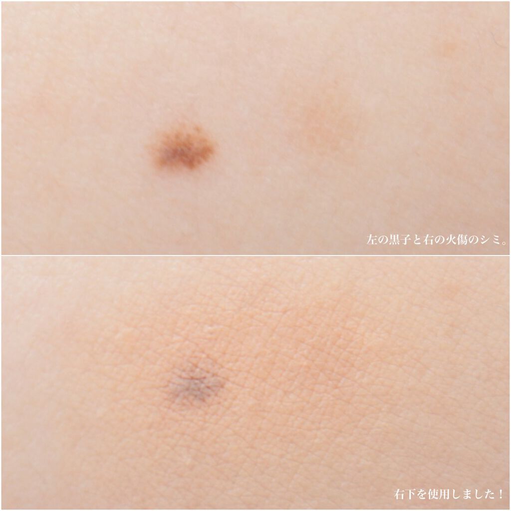 スキンリフレクト フレッシュ コンシーラー/ADDICTION/パレットコンシーラーを使ったクチコミ(6枚目)