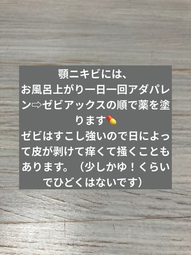 ディフェリンゲル0.1%/ガルデルマ/その他スキンケアを使ったクチコミ（2枚目）