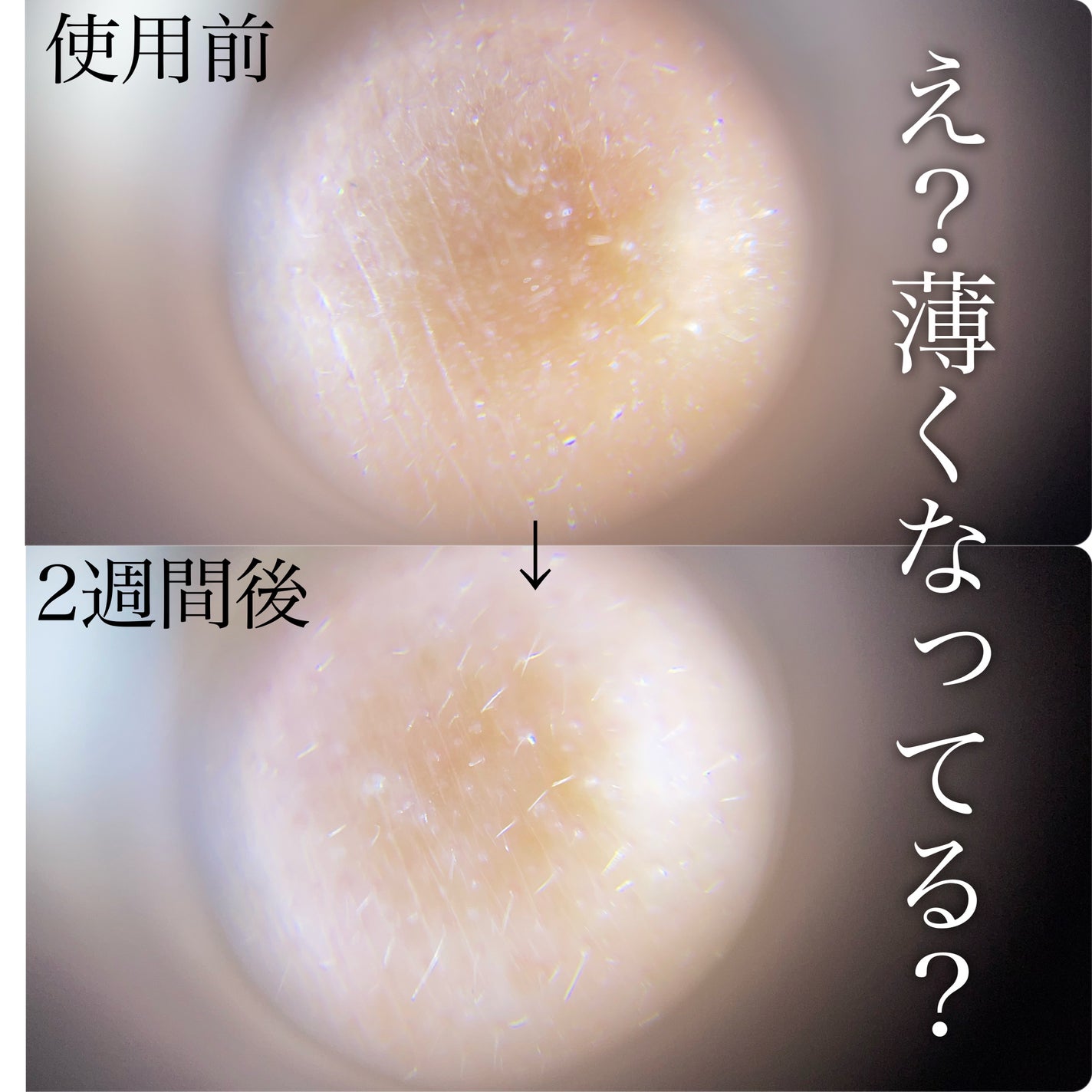 TXトーニングエッセンス2000/VT/美容液を使ったクチコミ(3枚目)