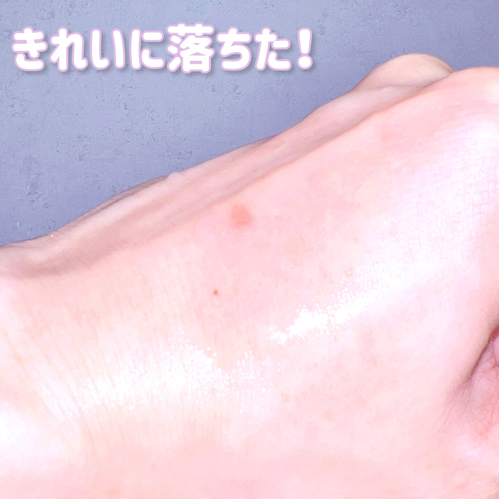 manage 00 ブースタークレンジング/manage/クレンジングジェルを使ったクチコミ（3枚目）