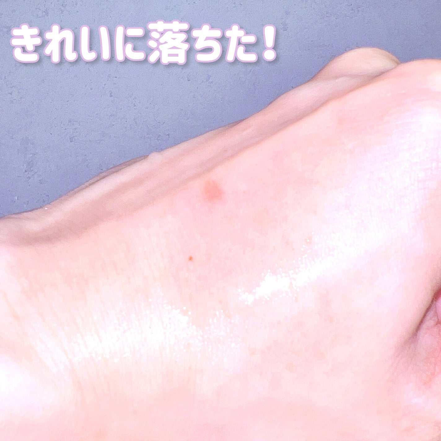 manage 00 ブースタークレンジング/manage/クレンジングジェルを使ったクチコミ(3枚目)