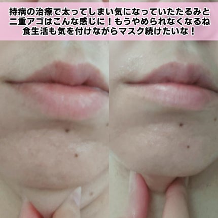 9番 NMNバイオリフトラッピングマスク/numbuzin/シートマスク・パックを使ったクチコミ(8枚目)